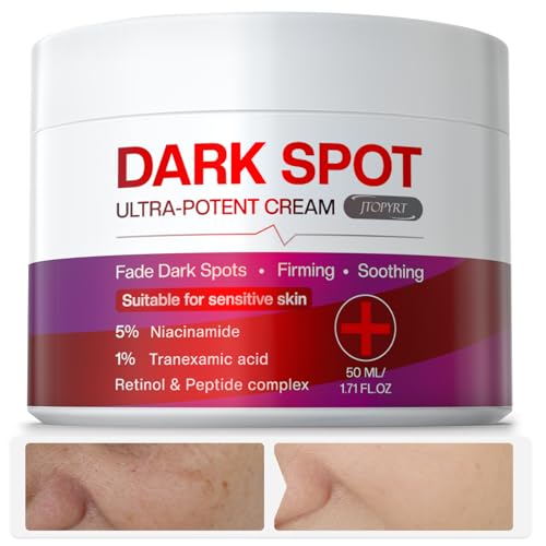 Dark Spot Cream: Brightening Treatment Diminishes Age Spots, Sun-Damage, Liver Spots, Freckles & Discoloration For Younger Looking Skin - Fader & Corrector For Face, Chest, Hands & Body - 50ml