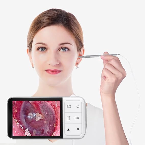 Ear Otoscope Camera, Digital Otoscope, 4.5-inch IPS HD Display, 6 LED Lights, 3.9mm Lens Diameter, 200W High-Precision Endoscope, for Kids, Adults, Pets