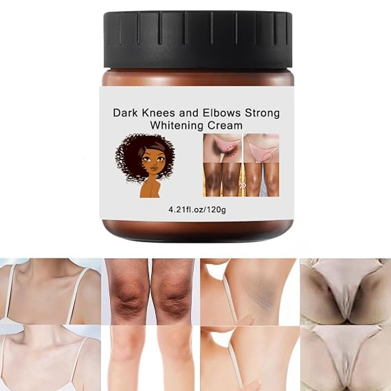 120g Cremas Para Las Manchas de La Corporales, Para Piel Entrepierna, Manchas Codos, Piernas Zonas, Intimas Cara Axilas, Rodillas Cuello