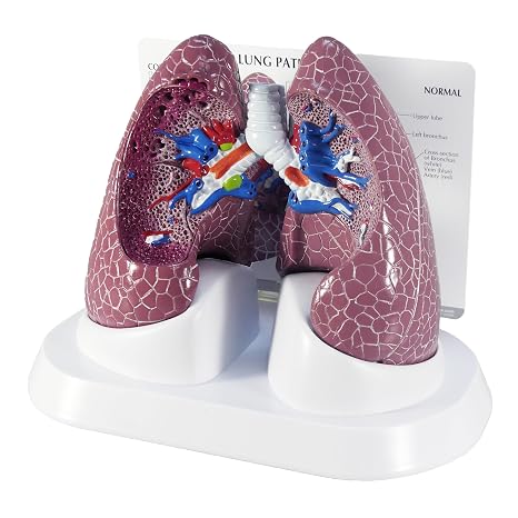 GPI Anatomicals Lung Model Set with Pathologies